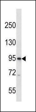 ANTI-CNGB3 (N-TERM) antibody produced in rabbit IgG fraction of antiserum, buffered aqueous solution