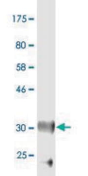 Monoclonal Anti-MFRP, (C-terminal) antibody produced in mouse clone 3H5, purified immunoglobulin, buffered aqueous solution