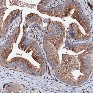 Anti-WDR11 antibody produced in rabbit Prestige Antibodies&#174; Powered by Atlas Antibodies, affinity isolated antibody, buffered aqueous glycerol solution