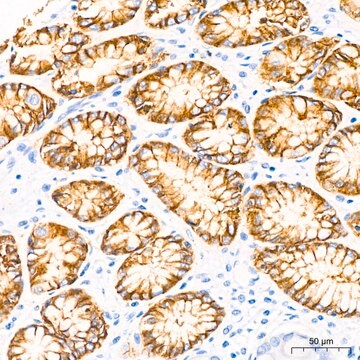 Anti-CLDN18.2 Antibody, clone 3J4G7, Rabbit Monoclonal