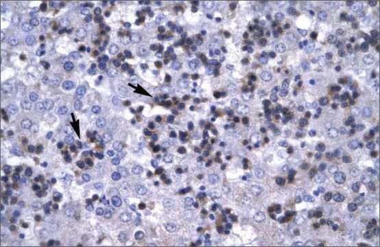 Anti-RBPJ antibody produced in rabbit affinity isolated antibody