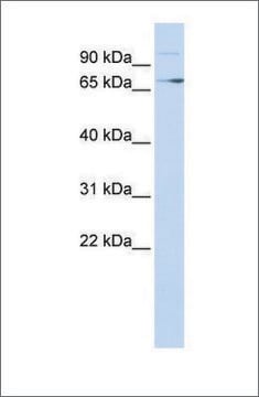 Anti-TP73 antibody produced in rabbit affinity isolated antibody