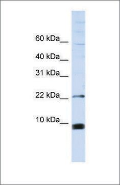 抗SNRPF抗体 ウサギ宿主抗体 affinity isolated antibody