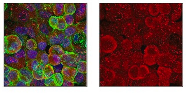 Anti-VAMP-3 Antibody from rabbit, purified by affinity chromatography