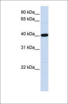 Anti-TMOD3 (ab2) antibody produced in rabbit affinity isolated antibody