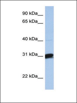 Anti-B3GALT6 (AB2) antibody produced in rabbit affinity isolated antibody