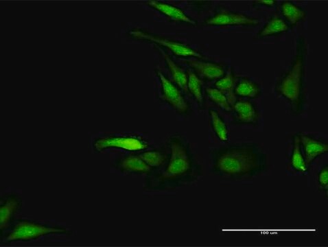 Anti-NPLOC4 antibody produced in rabbit purified immunoglobulin, buffered aqueous solution