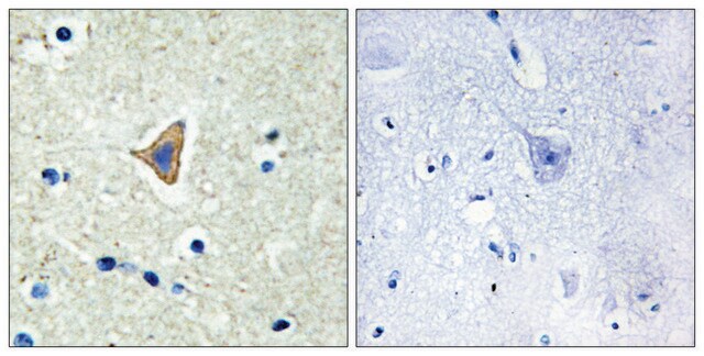 Anti-CDH20 antibody produced in rabbit affinity isolated antibody