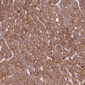 Anti-TRIM61 antibody produced in rabbit Prestige Antibodies&#174; Powered by Atlas Antibodies, affinity isolated antibody, buffered aqueous glycerol solution