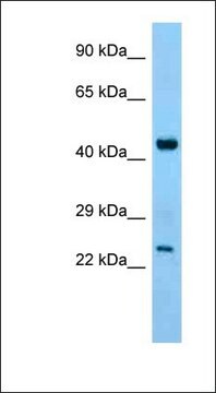 Anti-ABHD12 antibody produced in rabbit affinity isolated antibody