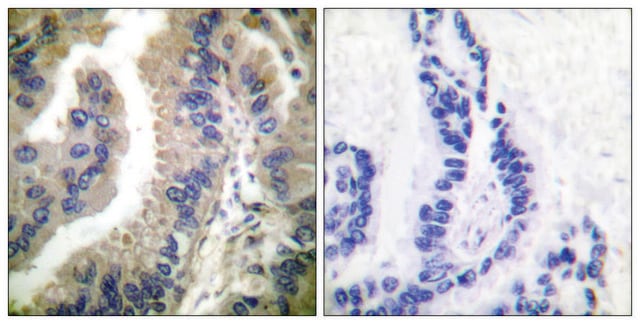 Anti-HSP90A antibody produced in rabbit affinity isolated antibody