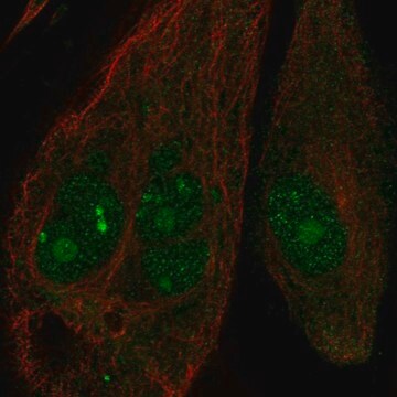 Anti-Ankrd30B Antibody Produced In Rabbit Prestige Antibodies&#174; Powered by Atlas Antibodies, affinity isolated antibody, buffered aqueous glycerol solution