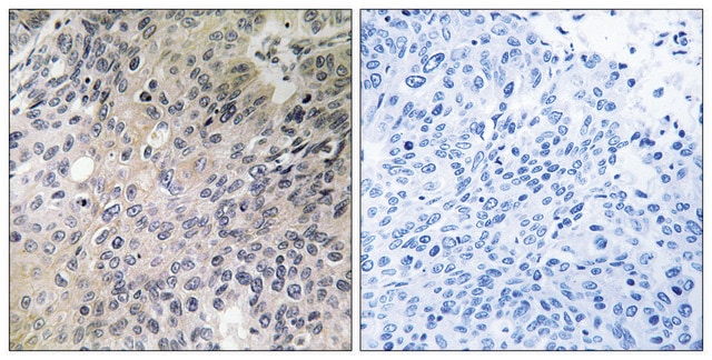 Anti-SHC3 antibody produced in rabbit affinity isolated antibody