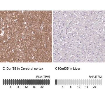 Anti-C10orf35 antibody produced in rabbit Prestige Antibodies&#174; Powered by Atlas Antibodies, affinity isolated antibody, buffered aqueous glycerol solution