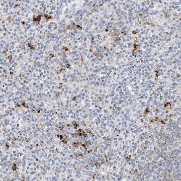 Anti-DPH3 antibody produced in rabbit Prestige Antibodies&#174; Powered by Atlas Antibodies, affinity isolated antibody, buffered aqueous glycerol solution