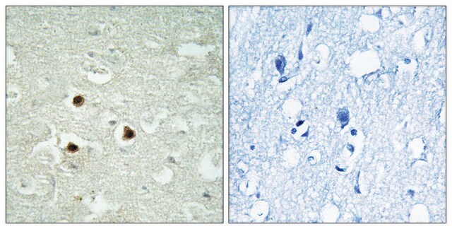 Anti-RAB3IP antibody produced in rabbit affinity isolated antibody