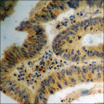 Anti-phospho-PLD1 (pSer561) antibody produced in rabbit affinity isolated antibody