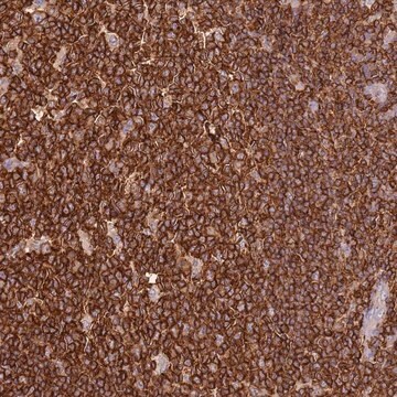 Anti-OR6P1 antibody produced in rabbit Prestige Antibodies&#174; Powered by Atlas Antibodies, affinity isolated antibody, buffered aqueous glycerol solution