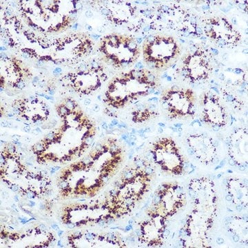 Anti-IGF1 antibody produced in rabbit