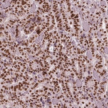 Monoclonal Anti-BRD4 antibody produced in mouse Prestige Antibodies&#174; Powered by Atlas Antibodies, clone CL1118, purified immunoglobulin, buffered aqueous glycerol solution