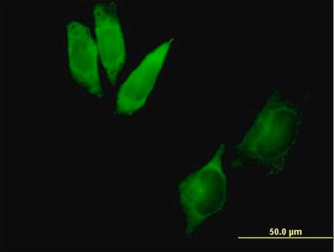 Anti-DYNC1I2 antibody produced in mouse purified immunoglobulin, buffered aqueous solution