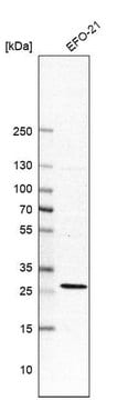 Anti-RIT1 antibody produced in rabbit Prestige Antibodies&#174; Powered by Atlas Antibodies, affinity isolated antibody, buffered aqueous glycerol solution