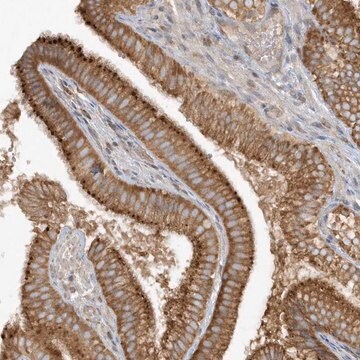 Anti-CNOT10 antibody produced in rabbit Prestige Antibodies&#174; Powered by Atlas Antibodies, affinity isolated antibody, buffered aqueous glycerol solution