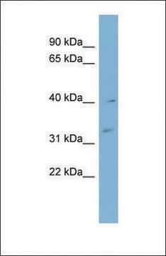 Anti-MYOZ1 antibody produced in rabbit affinity isolated antibody