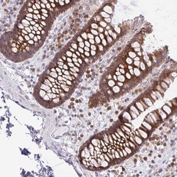 Anti-FAU antibody produced in rabbit Prestige Antibodies&#174; Powered by Atlas Antibodies, affinity isolated antibody, buffered aqueous glycerol solution