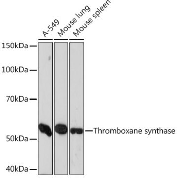 Anti-Thromboxane synthase Antibody, clone 6B7Z7, Rabbit Monoclonal