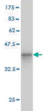 Monoclonal Anti-GCK antibody produced in mouse clone 3C7, purified immunoglobulin, buffered aqueous solution