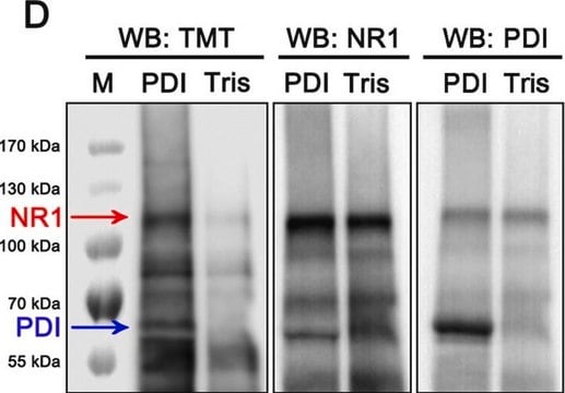 Anti-NMDAR1 Antibody, rabbit monoclonal culture supernatant, clone 1.17.2.6, Chemicon&#174;