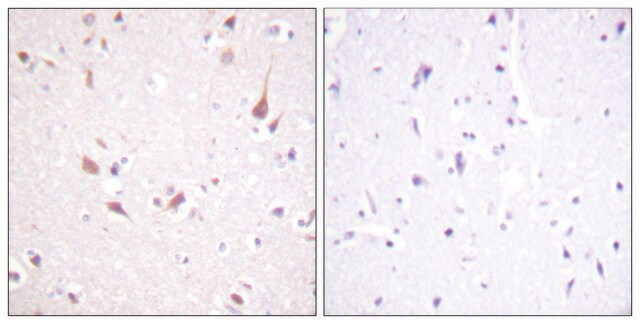 Anti-MST1 antibody produced in rabbit affinity isolated antibody