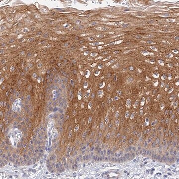 Anti-HOXB1 antibody produced in rabbit Prestige Antibodies&#174; Powered by Atlas Antibodies, affinity isolated antibody, buffered aqueous glycerol solution