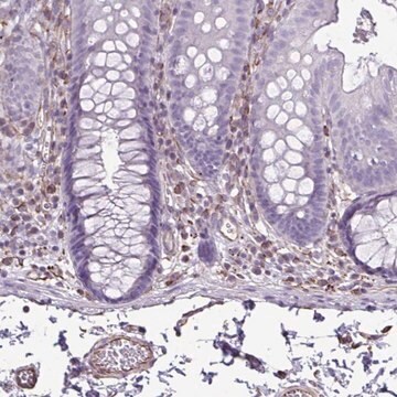 Anti-TMEM86B antibody produced in rabbit Prestige Antibodies&#174; Powered by Atlas Antibodies, affinity isolated antibody, buffered aqueous glycerol solution