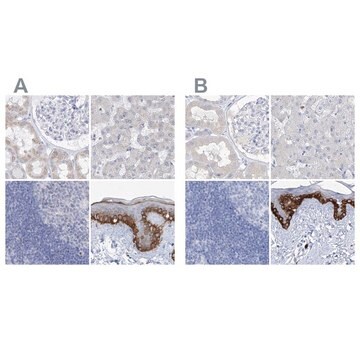 Anti-FRS3 antibody produced in rabbit Prestige Antibodies&#174; Powered by Atlas Antibodies, affinity isolated antibody, buffered aqueous glycerol solution, ab1