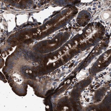 Anti-TOP1MT antibody produced in rabbit Prestige Antibodies&#174; Powered by Atlas Antibodies, affinity isolated antibody, buffered aqueous glycerol solution