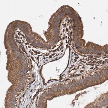 Anti-ZNF347 antibody produced in rabbit Prestige Antibodies&#174; Powered by Atlas Antibodies, affinity isolated antibody, buffered aqueous glycerol solution