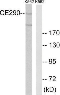 Anti-CEP290 antibody produced in rabbit affinity isolated antibody