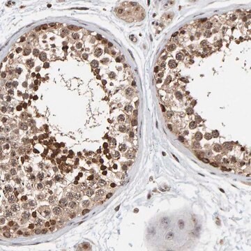 Anti-CCDC182 antibody produced in rabbit Prestige Antibodies&#174; Powered by Atlas Antibodies, affinity isolated antibody, buffered aqueous glycerol solution, Ab1