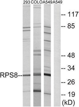 Anti-RPS8 antibody produced in rabbit affinity isolated antibody