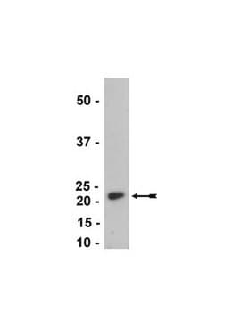 Anti-NY-ESO-1 Antibody, clone E978 ascites fluid, clone E978, Upstate&#174;