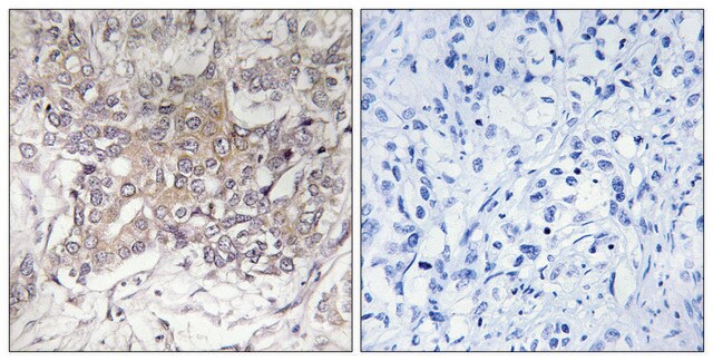 Anti-GCNT3 antibody produced in rabbit affinity isolated antibody