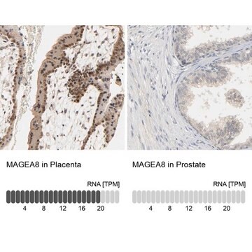 Anti-MAGEA8 antibody produced in rabbit Prestige Antibodies&#174; Powered by Atlas Antibodies, affinity isolated antibody, buffered aqueous glycerol solution