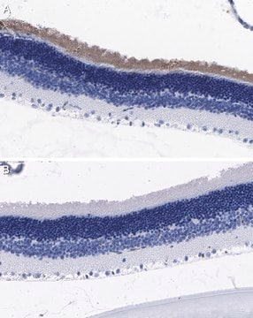 Anti-CNGA1/CNG1 Antibody, clone PMc 1D1