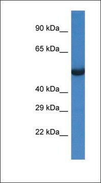 Anti-SESN1 antibody produced in rabbit affinity isolated antibody