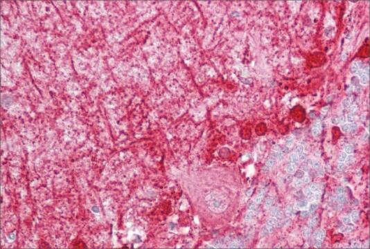 Anti-DBI antibody produced in rabbit affinity isolated antibody