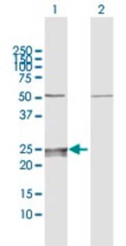 Anti-CMPK1 antibody produced in rabbit purified immunoglobulin, buffered aqueous solution