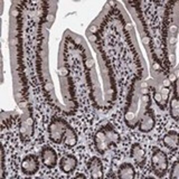 Anti-RPRD1B antibody produced in rabbit Prestige Antibodies&#174; Powered by Atlas Antibodies, affinity isolated antibody, buffered aqueous glycerol solution