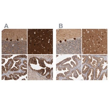 Anti-BAIAP2 antibody produced in rabbit affinity isolated antibody, buffered aqueous glycerol solution